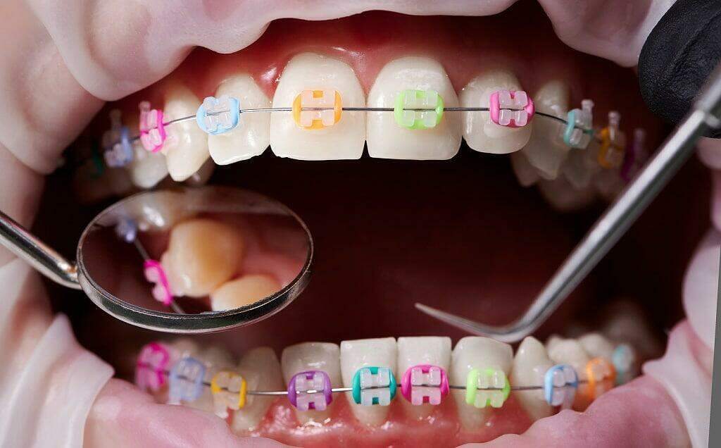 Bruma Orthodontist